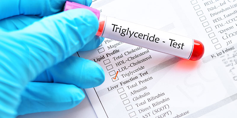 Close-up image of a medical lab expert performing a Triglycerides test.