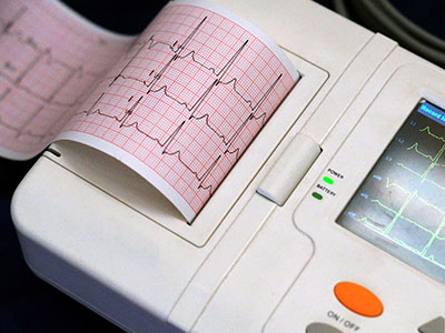 Image of an ECG machine with heart pulse signals printed on a graph.