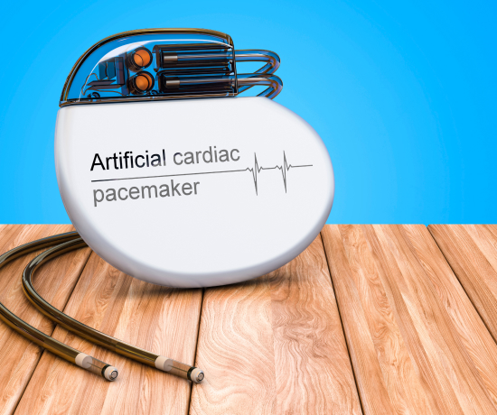 A cardiac pacemaker with catheters.