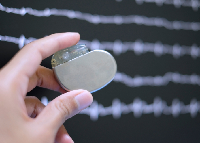 A person holding a pacemaker.