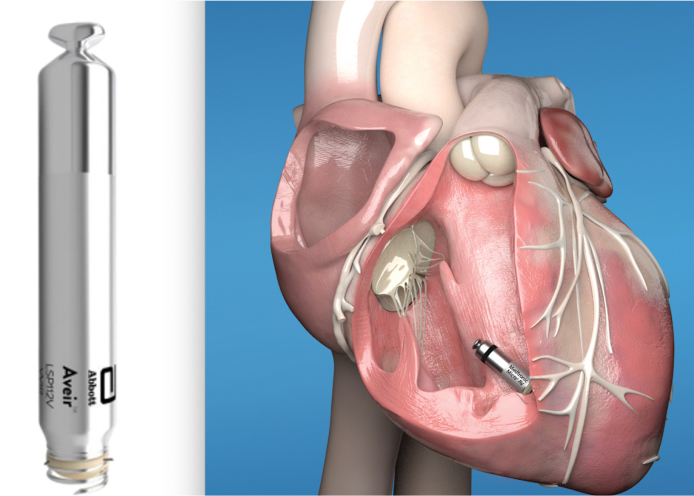 A collage image showing a leadless pacemaker and a heart model with a leadless pacemaker.