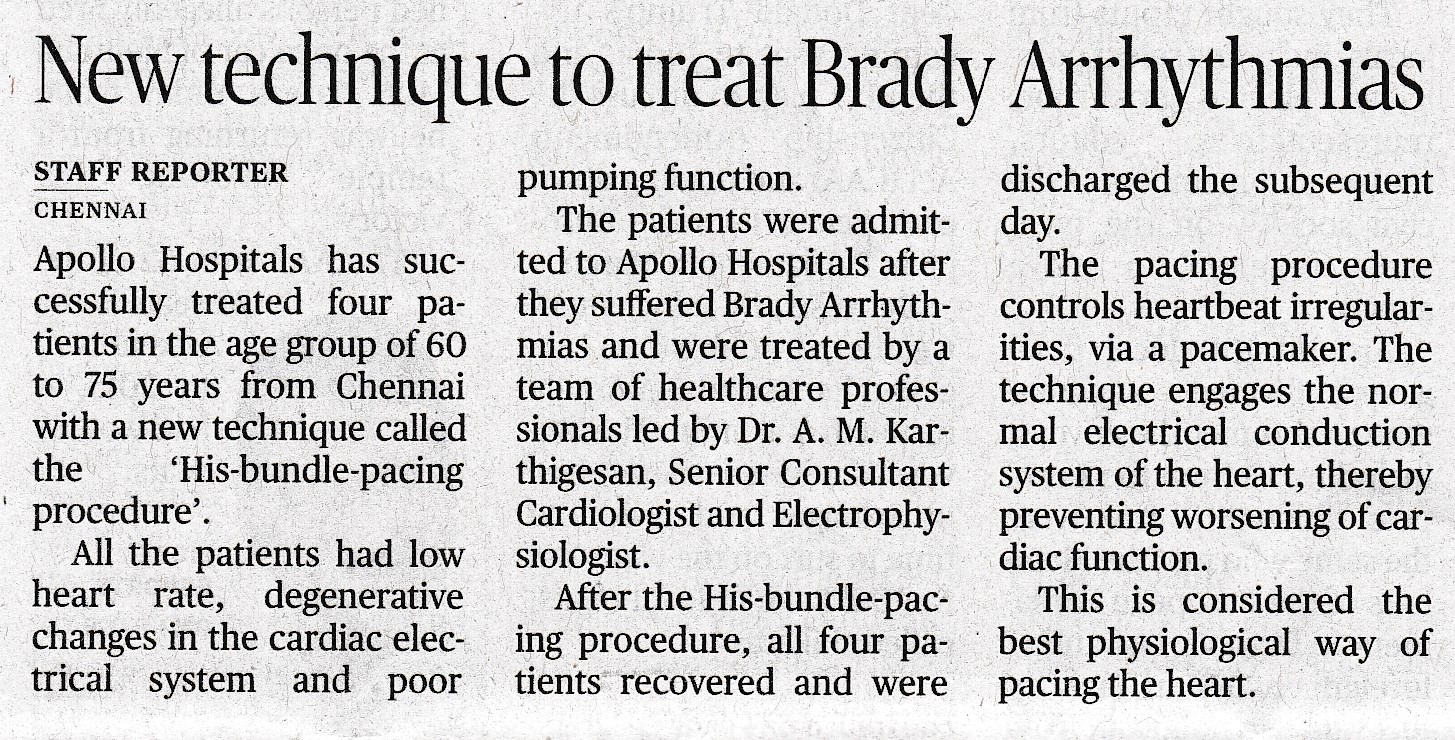 Image of a news clipping about the new techniques to correct Brady Arrhythmias.