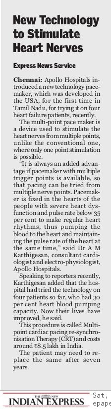 Image of a news article about technology to stimulate heart nerves by Dr. Karthigesan A.M.