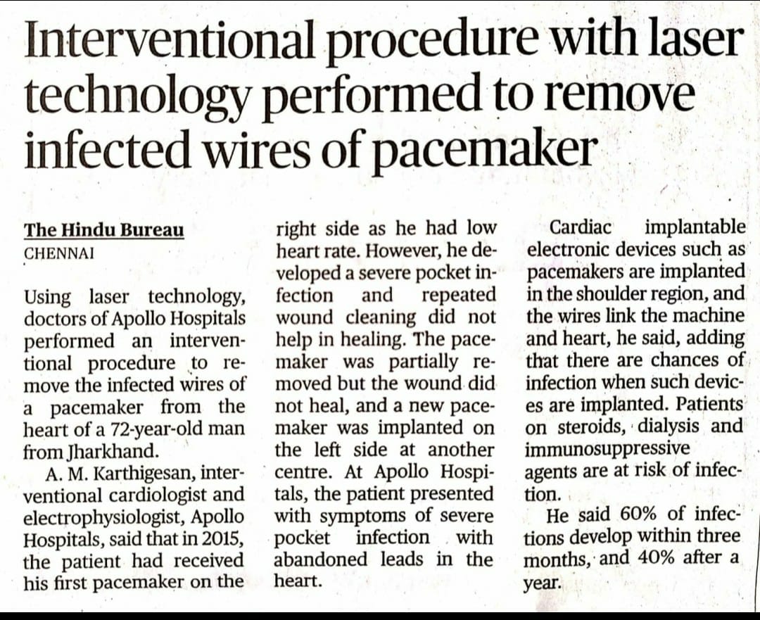 Image of a news article in the Hindu Bureau about the treatment for an elderly person with pacemaker infection by Dr. Karthigesan.